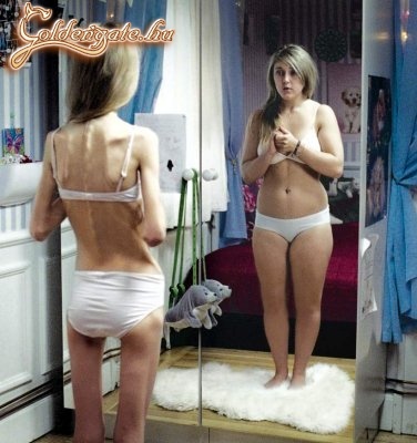 Hát igen az anorexia