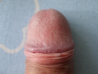 faroképII