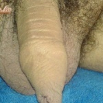 Szőrös farok, zacsi, fityma, fenék, mellkas, poci - 8. kép