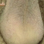 Szőrös farok, zacsi, fityma, fenék, mellkas, poci - 9. kép