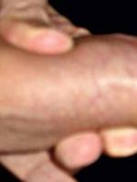 nonis9