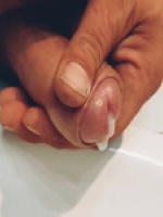 Lali81