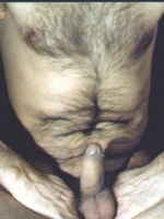 drotszamar