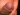 Piercingesfasz